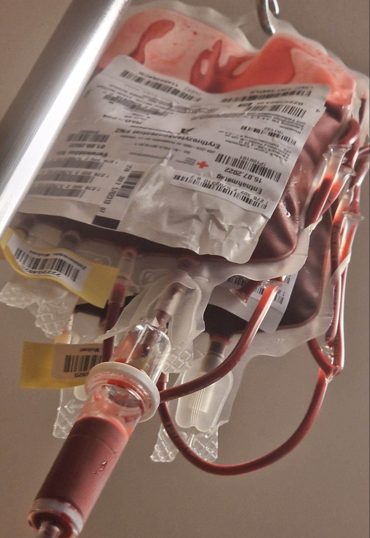 Bild von einer Bluttransfusion