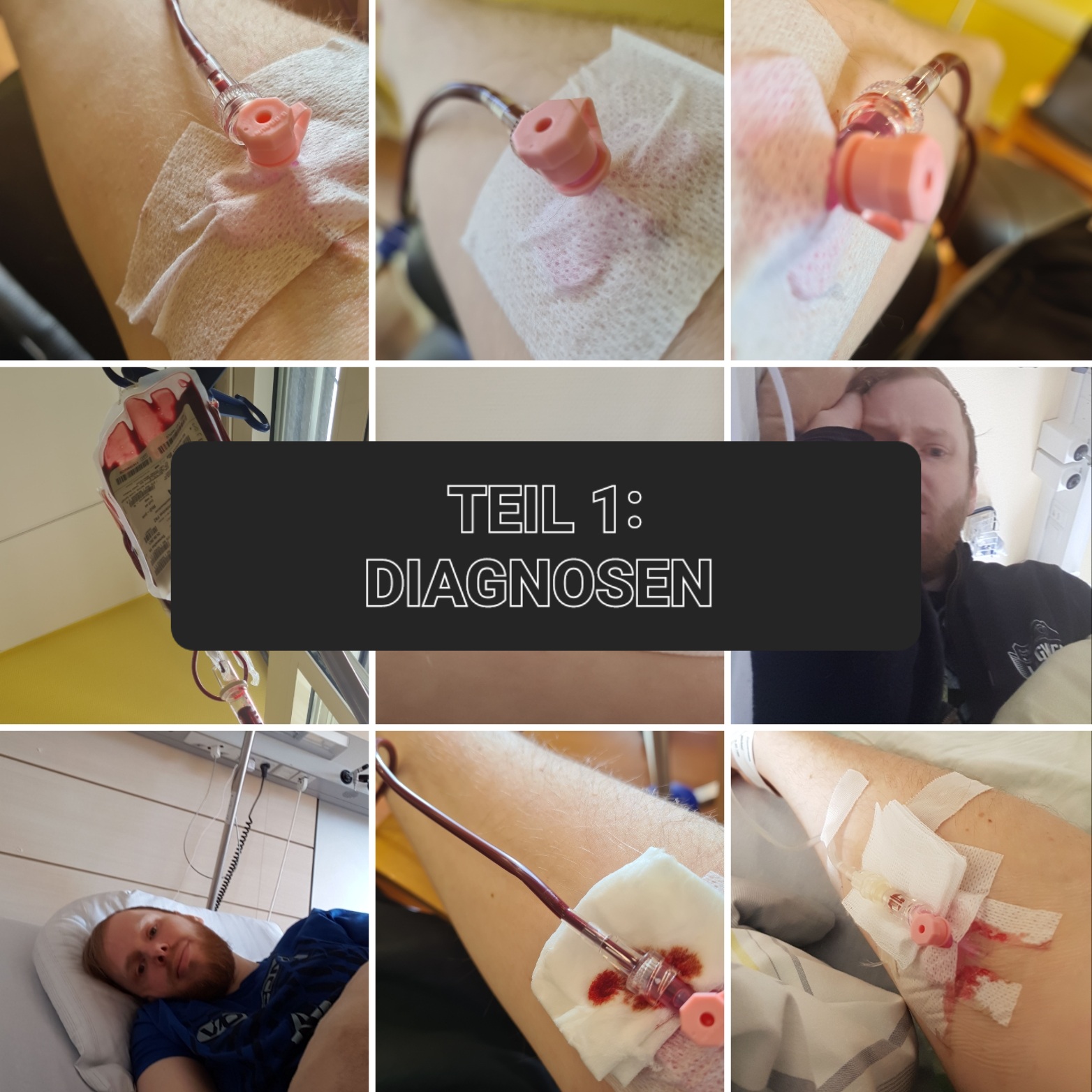 Collage mit verschiedenen Fotos von mir während der Anämie